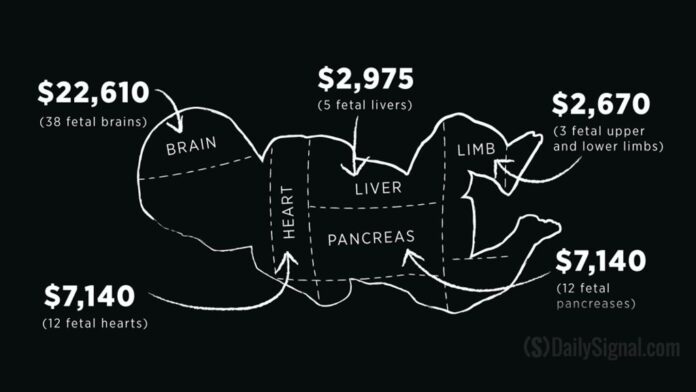 Market for Fetal Body Parts