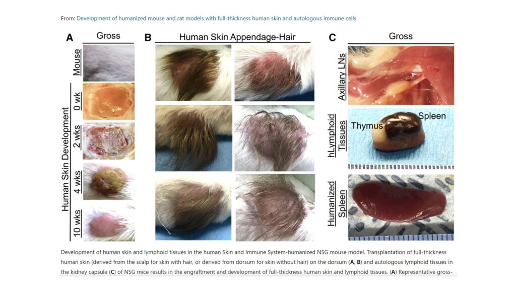 Human Skin Appendage-Hair