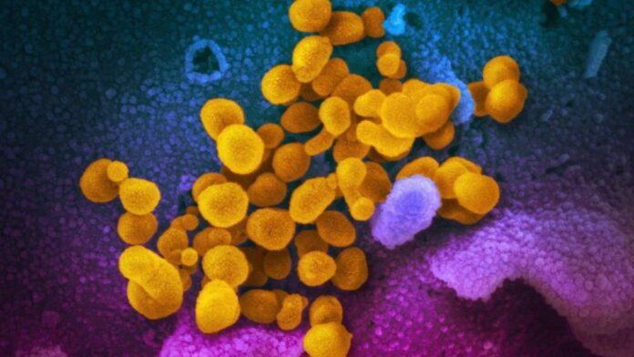 Novel Coronavirus SARS-CoV-2 Novel Coronavirus SARS-CoV-2