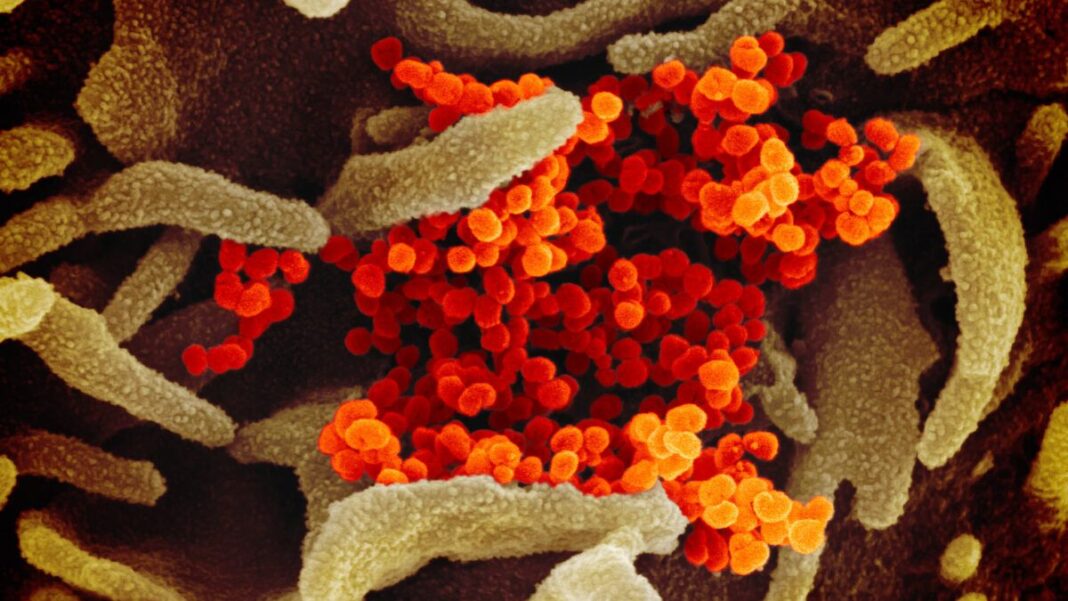 Electron Microscope Image Shows COVID-19 Virus