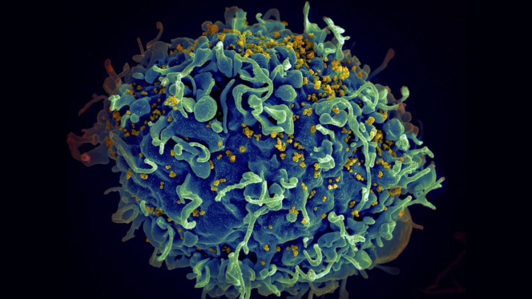 The human immunodeficiency virus (yellow) infecting a human cell.