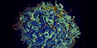 The human immunodeficiency virus (yellow) infecting a human cell.