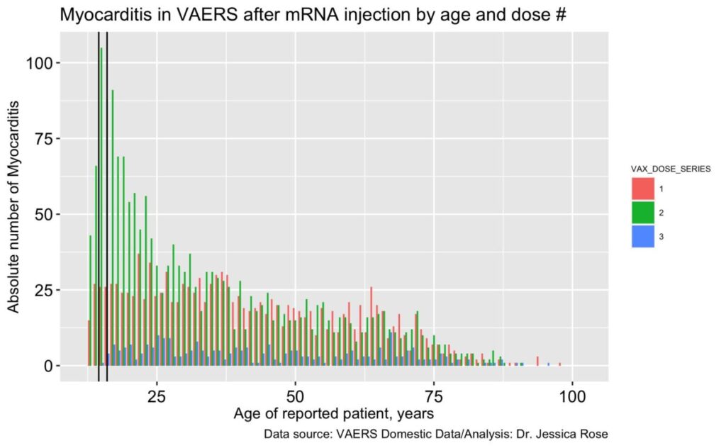 A graph showing age against absolute number of myocarditis reports filed to VAERS according to doses 1, 2 and 3 of the COVID-19 vaccines. (Jessica Rose)