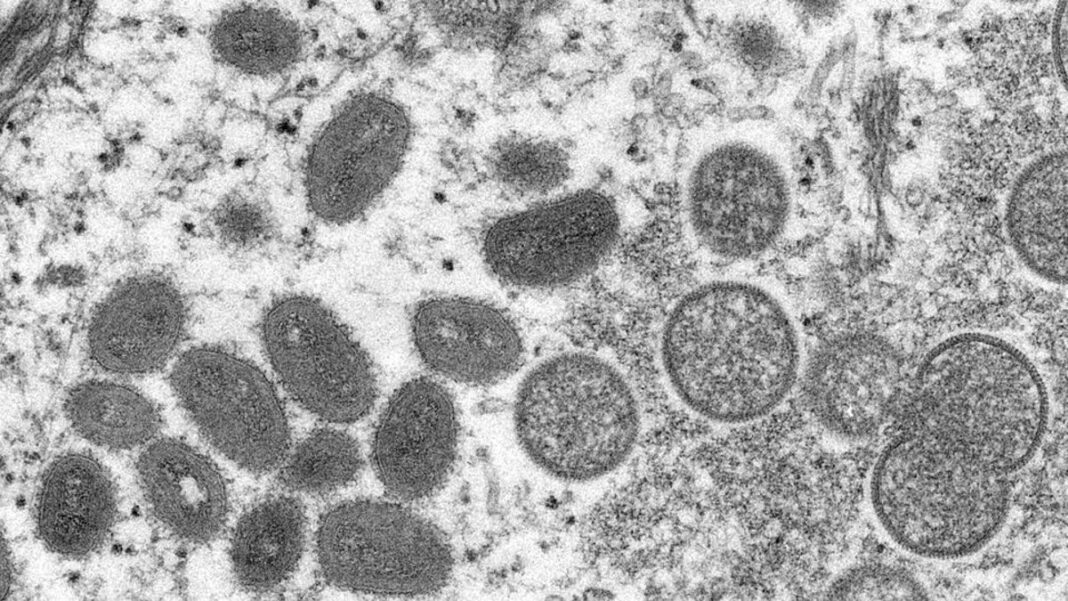 Monkeypox Virus Particles