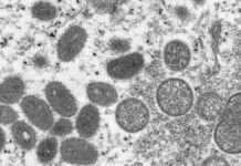 Monkeypox Virus Particles