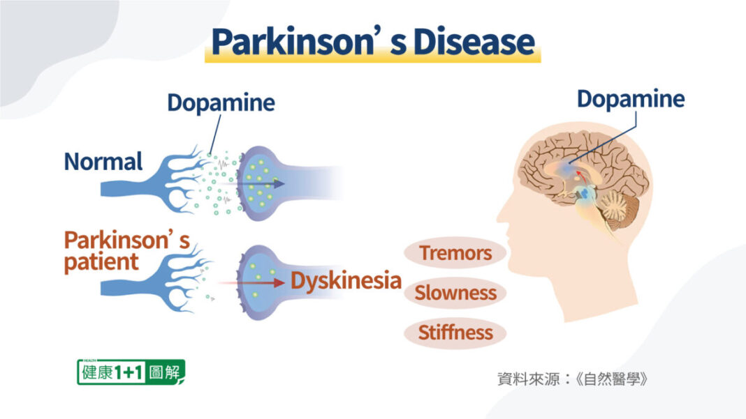 Parkinson's Disease