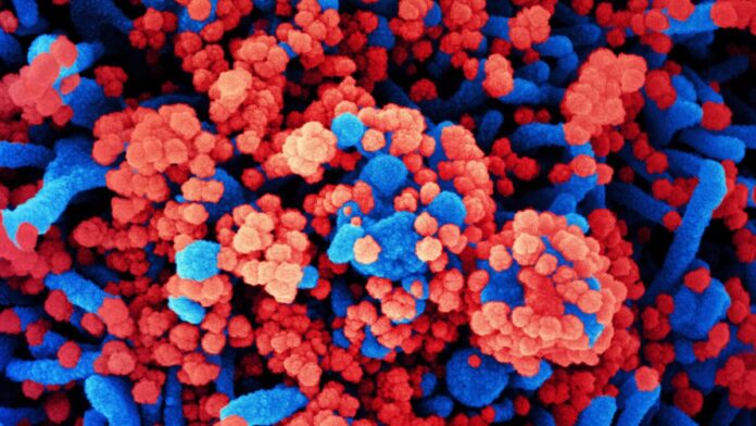 colorized scanning electron micrograph of a cell colorized scanning electron micrograph of a cell