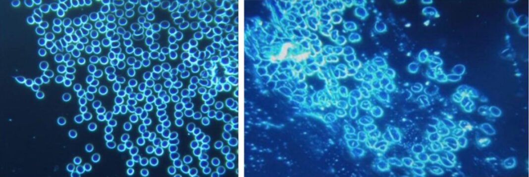 Blood Before and After mRNA Vaccine