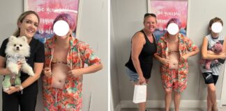 Double mastectomy for the purposes of treating gender dysphoria.