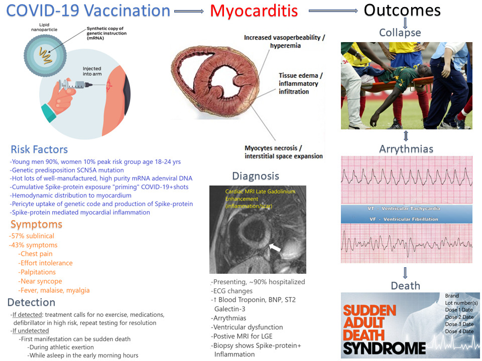 Covid-19 Vaccination - Myocarditis - Outcomes