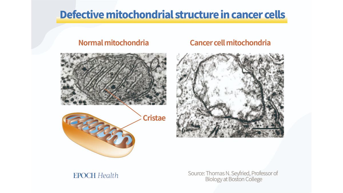 Defective Mitochondria Structure in cancer cells