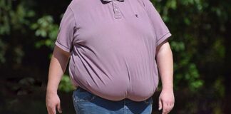 Obese Man