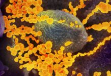 An electron microscope image shows SARS-CoV-2