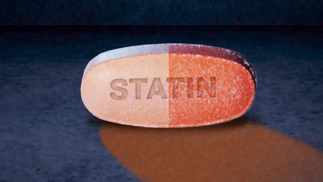 Statin