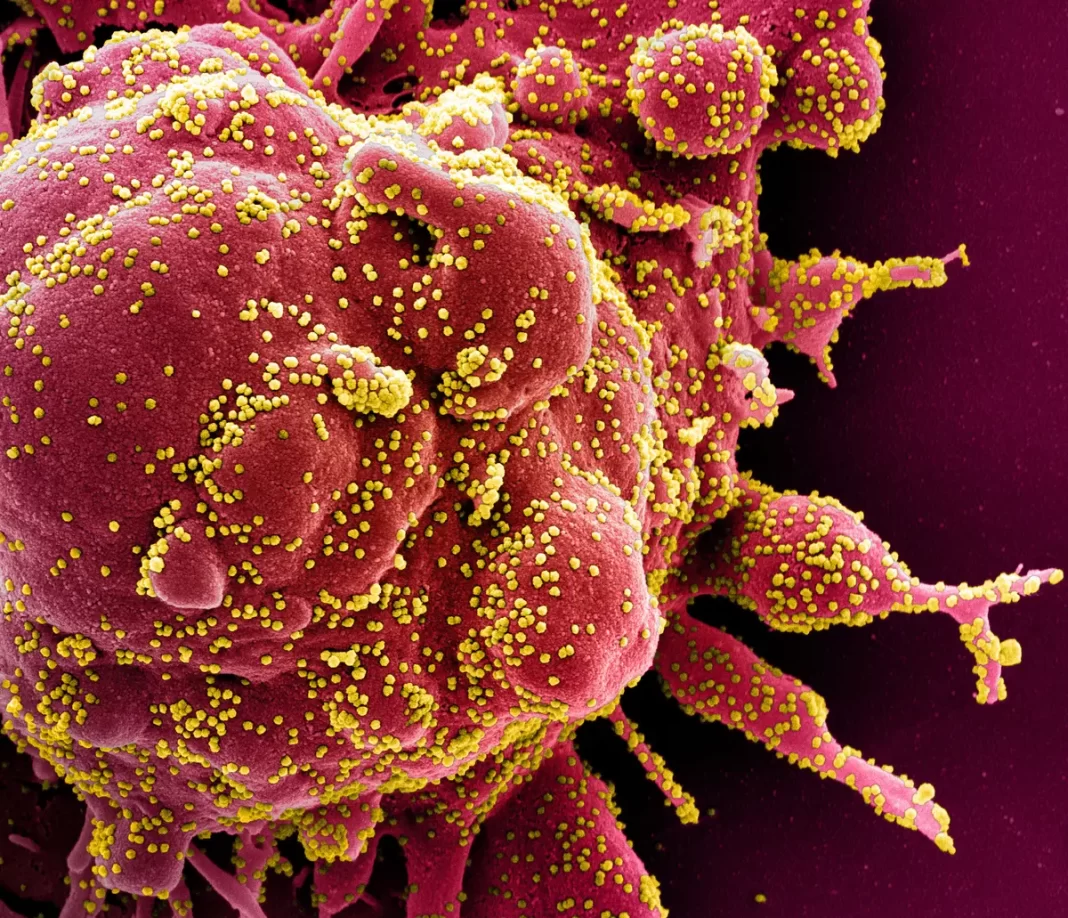 Colorized scanning electron micrograph of an apoptotic cell (red) heavily infected with CCP virus