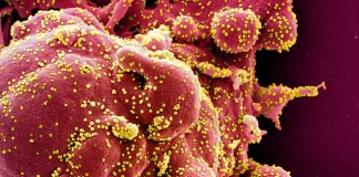 Colorized scanning electron micrograph of an apoptotic cell (red) heavily infected with CCP virus