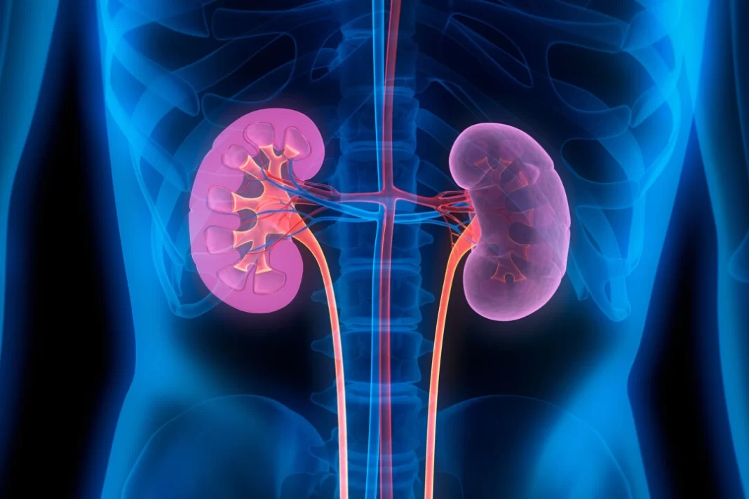 Kidney Complications