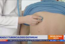 Long Beach declares public health emergency after deadly tuberculosis outbreak