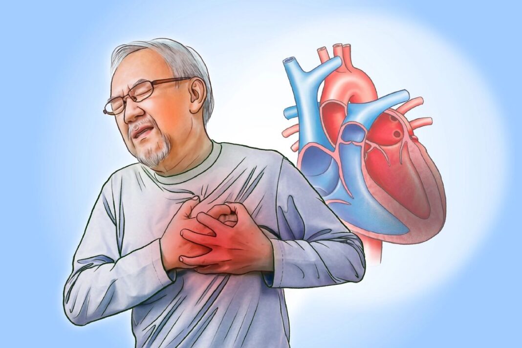 Heart Disease: When Chest Pain Becomes Serious–Here Are the Causes