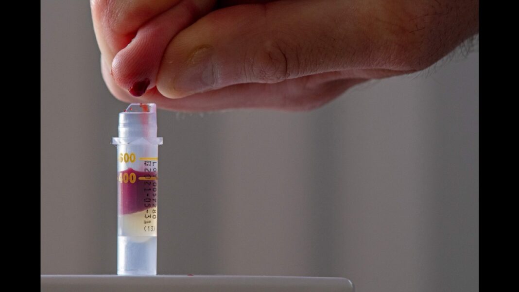 Blood Tests Now Recommended for Colon Cancer Screening